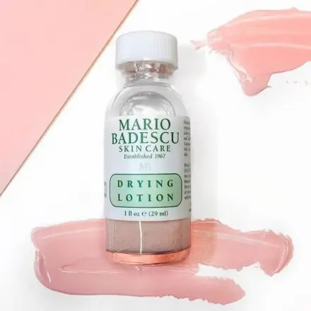 Review Mario Badescu Drying Lotion: Chấm mụn qua đêm có thực sự hiệu quả?