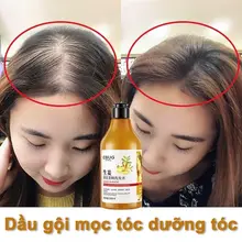 dầu gội chống rụng tóc và kích thích mọc tóc chính hãng 500ml giảm rụng tóc Mọc Tóc Nhanh kiểm soát dầu loại bỏ gàu