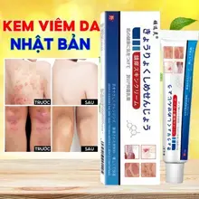Kem bôi hắc lào, viêm da cơ địa, nấm ngứa, á sừng, lang ben, vẩy nến... Chiết xuất từ thảo mộc tự nhiên( tuýp nhật0