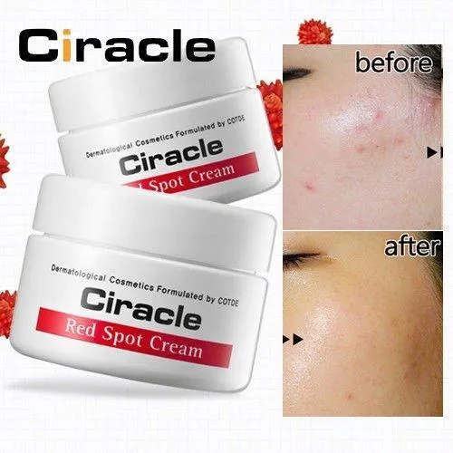 Cách sử dụng Ciracle Red Spot Cream