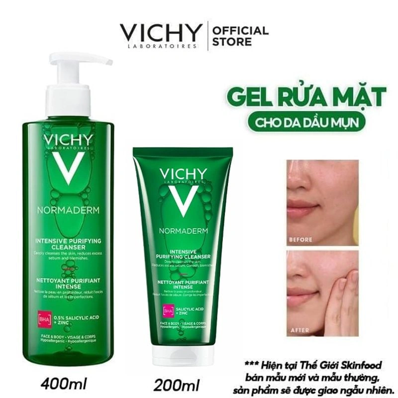Vichy Normaderm Phytosolution cho da dầu mụn nhạy cảm